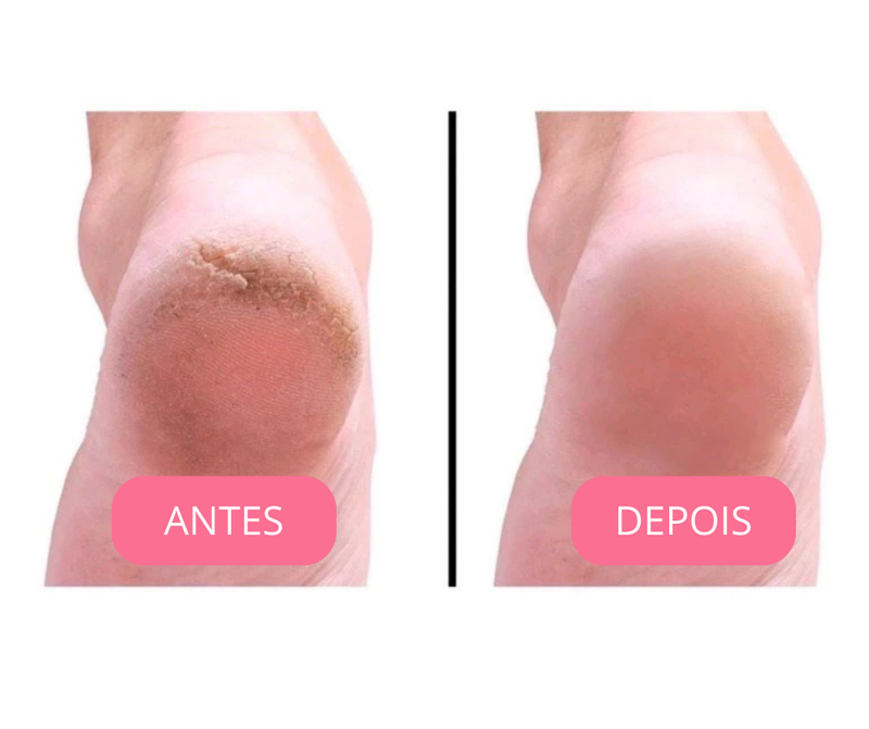 Par de palmilhas em gel ortopédica - Compre 1 e leve 2: TEMPO LIMITADO!!